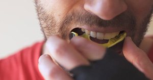 Man placing a mouthguard in his mouth