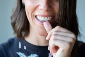 Woman placing Invisalign aligner on her teeth